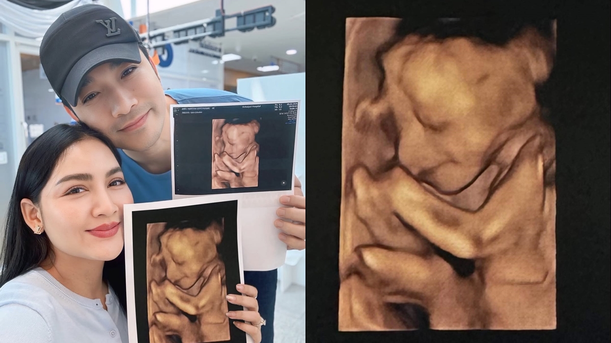 ครูก้อย นัชชา เจมส์ เรืองศักดิ์