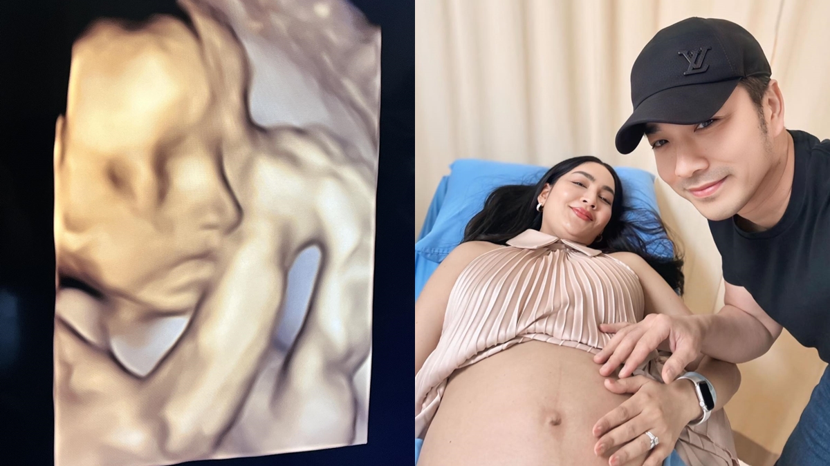 ครูก้อย นัชชา เจมส์ เรืองศักดิ์